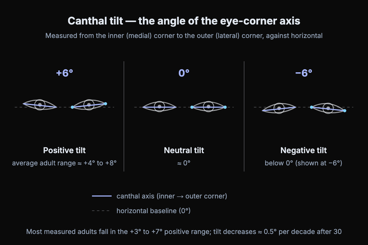 Diagram of positive, neutral and negative canthal tilt angles: the eye-corner axis tilted upward around +6 degrees, level at 0 degrees, and downward around −6 degrees against a horizontal baseline