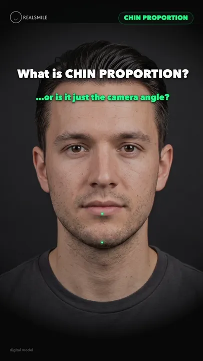 Chin proportion — projection, posture, and the lens — RealSmile 60-second explainer