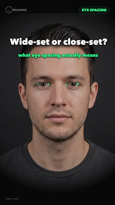 Wide-set vs close-set eyes — what spacing really means — RealSmile 60-second explainer