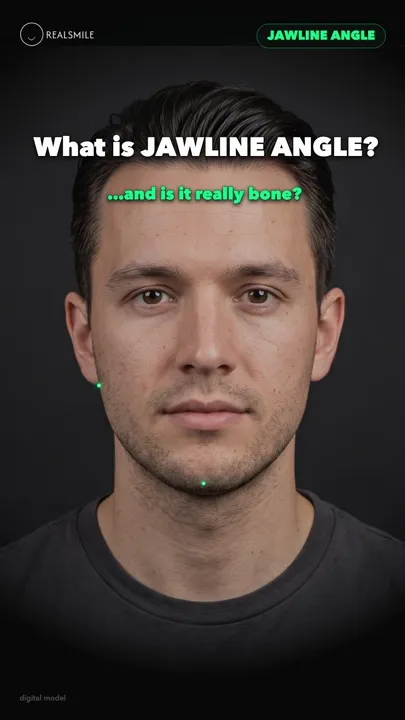 Jawline angle — how much of it is really bone? — RealSmile 60-second explainer