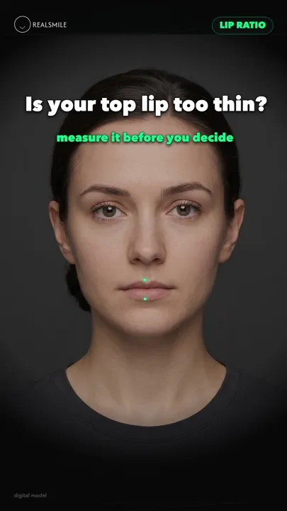 Upper-to-lower lip ratio — the honest read — RealSmile 60-second explainer